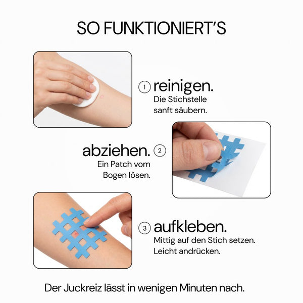 No Itch Please: So funktioniert es in 3 Schritten
