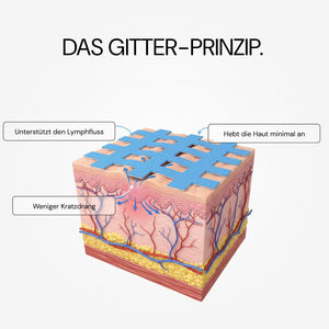 No Itch Please: Das Gitter-Prinzip auf der Haut erklärt