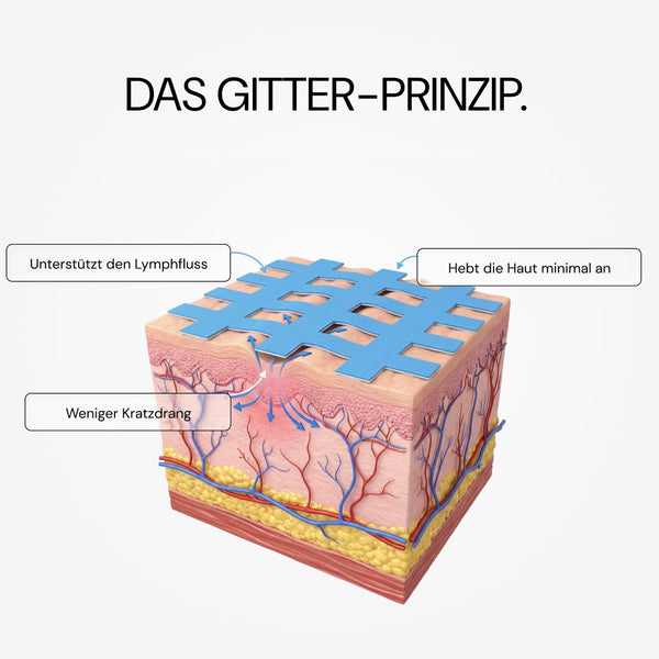No Itch Please: Das Gitter-Prinzip auf der Haut erklärt